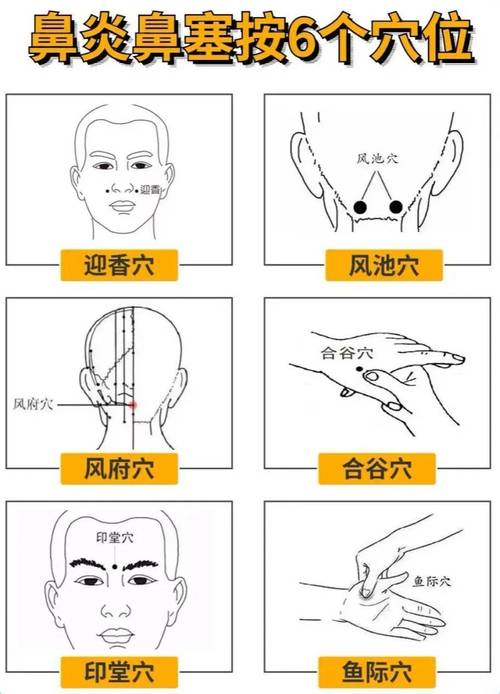 鼻子痛按压什么穴位