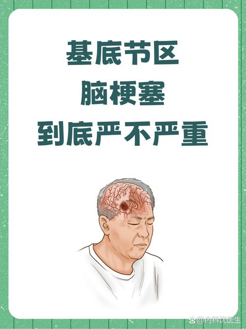 脑梗会一直走不了路吗