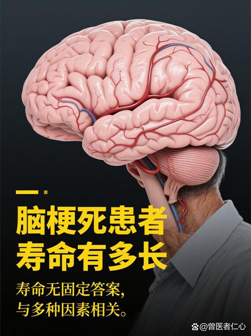 神经节苷脂对脑梗好吗