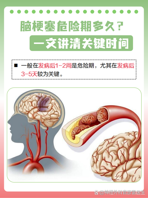 脑梗一个疗程多长时间
