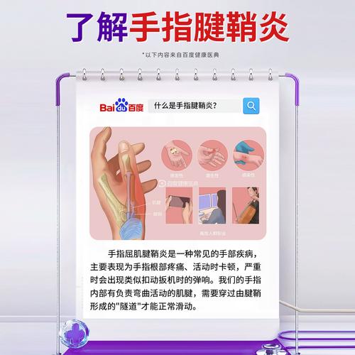 手指风湿性关节炎膏药