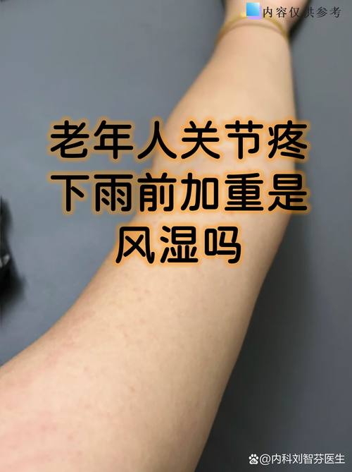 四肢隐隐作痛是风湿吗