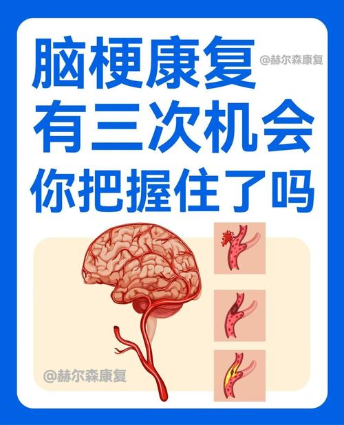 脑梗病人怎么能站起来