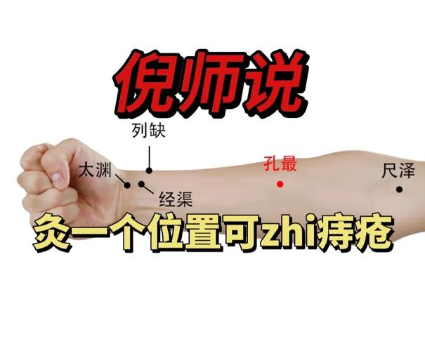 人体哪个穴位治痔疮