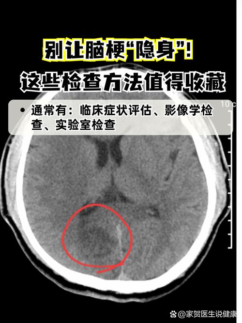 脑梗做ct能看出来吗