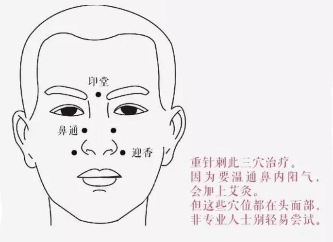 刮痧治疗鼻炎穴位图