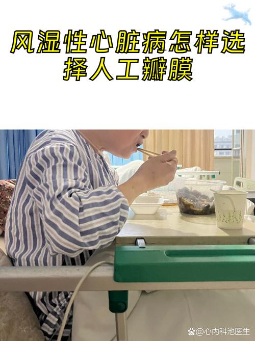 风湿性心脏病抗凝治疗
