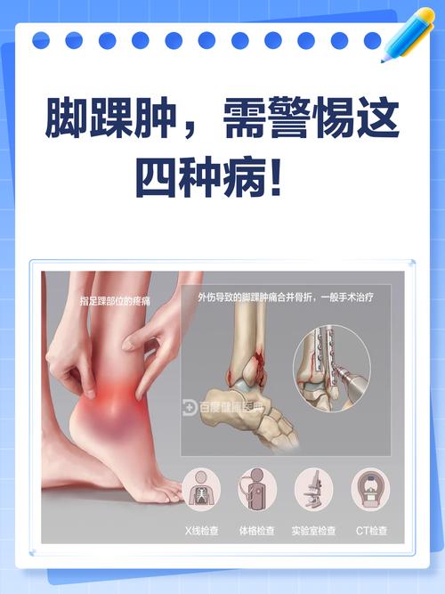 类风湿会引起脚脖肿吗