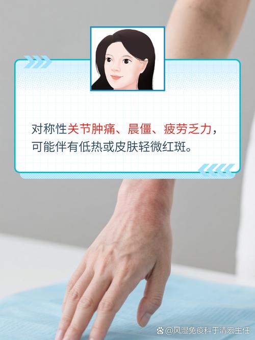 风湿三项正常但是晨僵