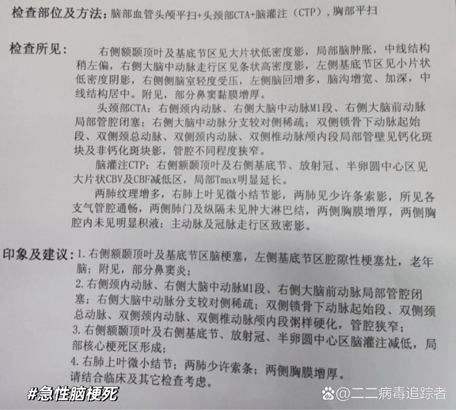 脑梗面积大了会怎么样