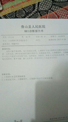 脑梗频发的结果是什么