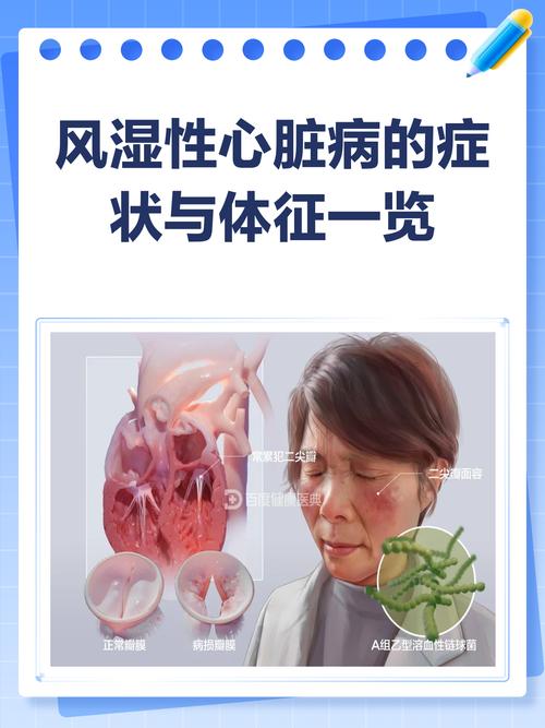 风湿性心脏瓣膜病体征