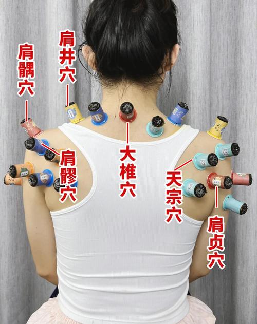 肩膀风湿灸哪些穴位