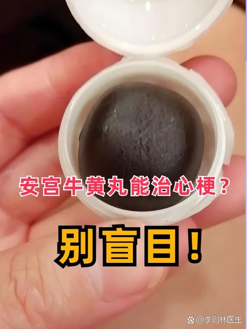 牛黄安宫丸能治脑梗吗