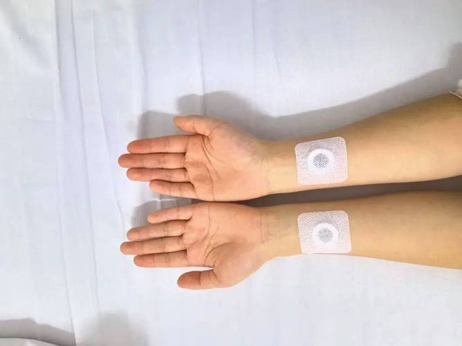 癌症水肿贴哪个穴位