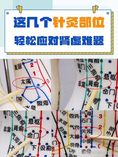 治疗肾虚的主要穴位