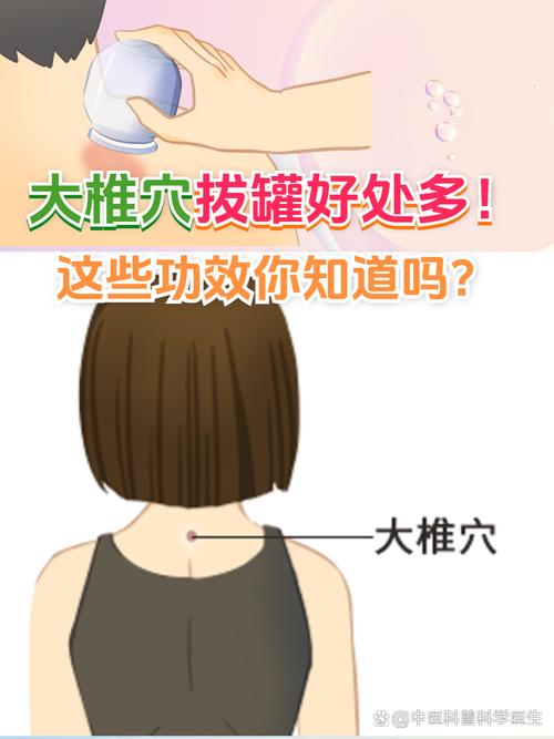 什么穴位不能拔罐子