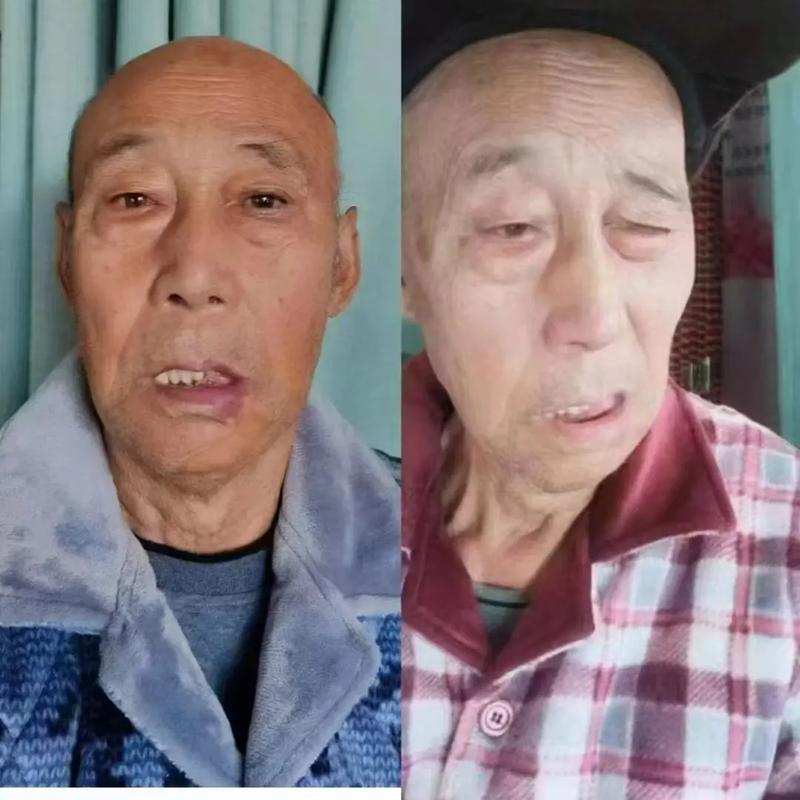 脑梗病人恢复期嘴歪了