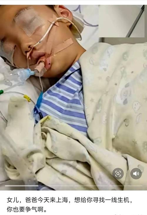 大面积脑梗第7天死亡