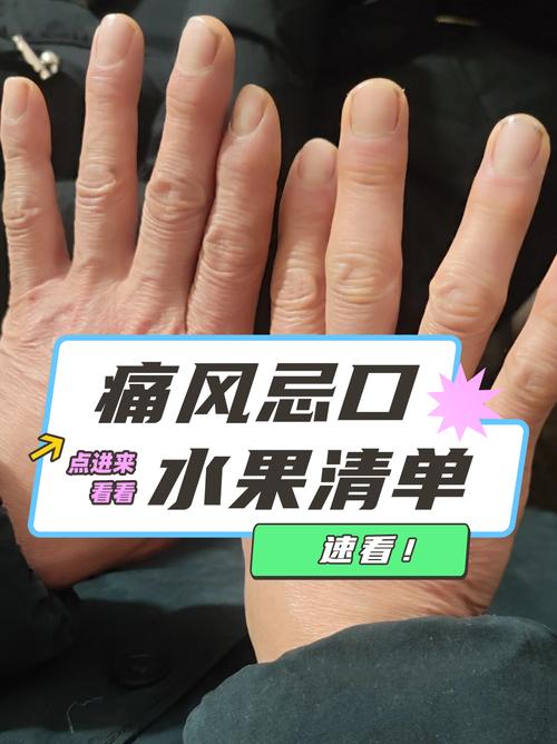 风湿痛不能吃什么水果