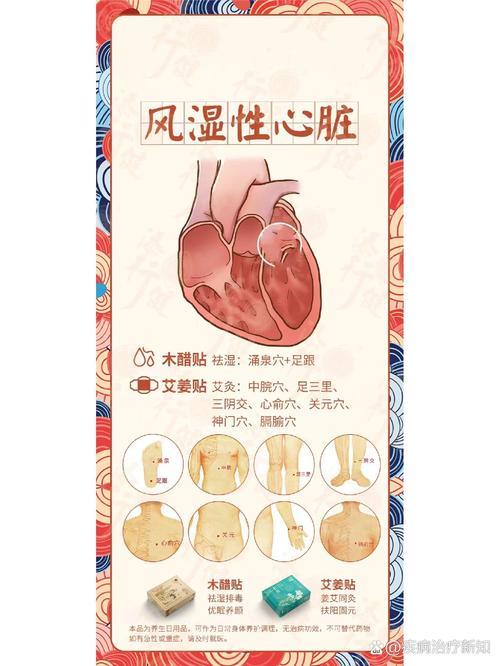 风湿性心脏病病变特点