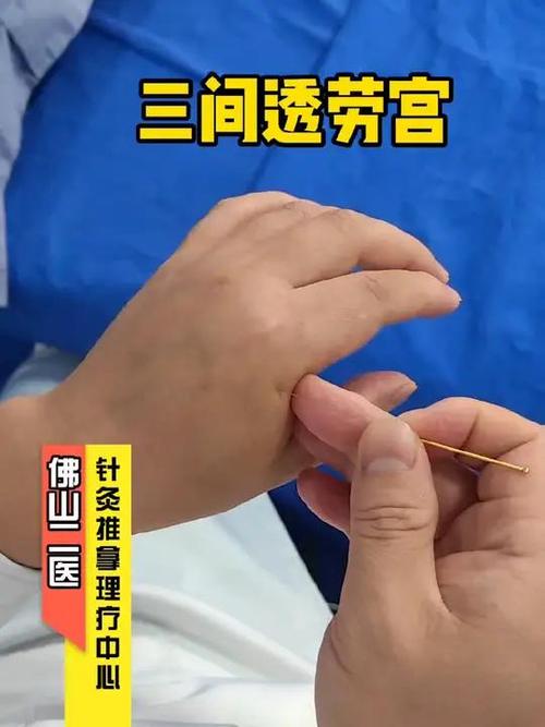 手脂风湿性关节做理疗