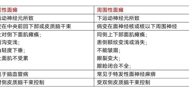 脑梗与面神经炎的鉴别