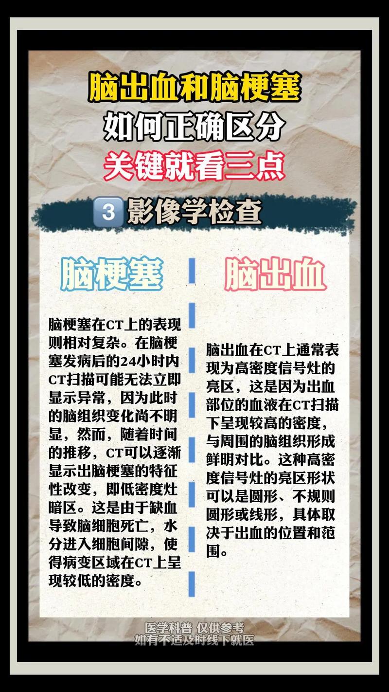 脑梗与面神经炎的鉴别