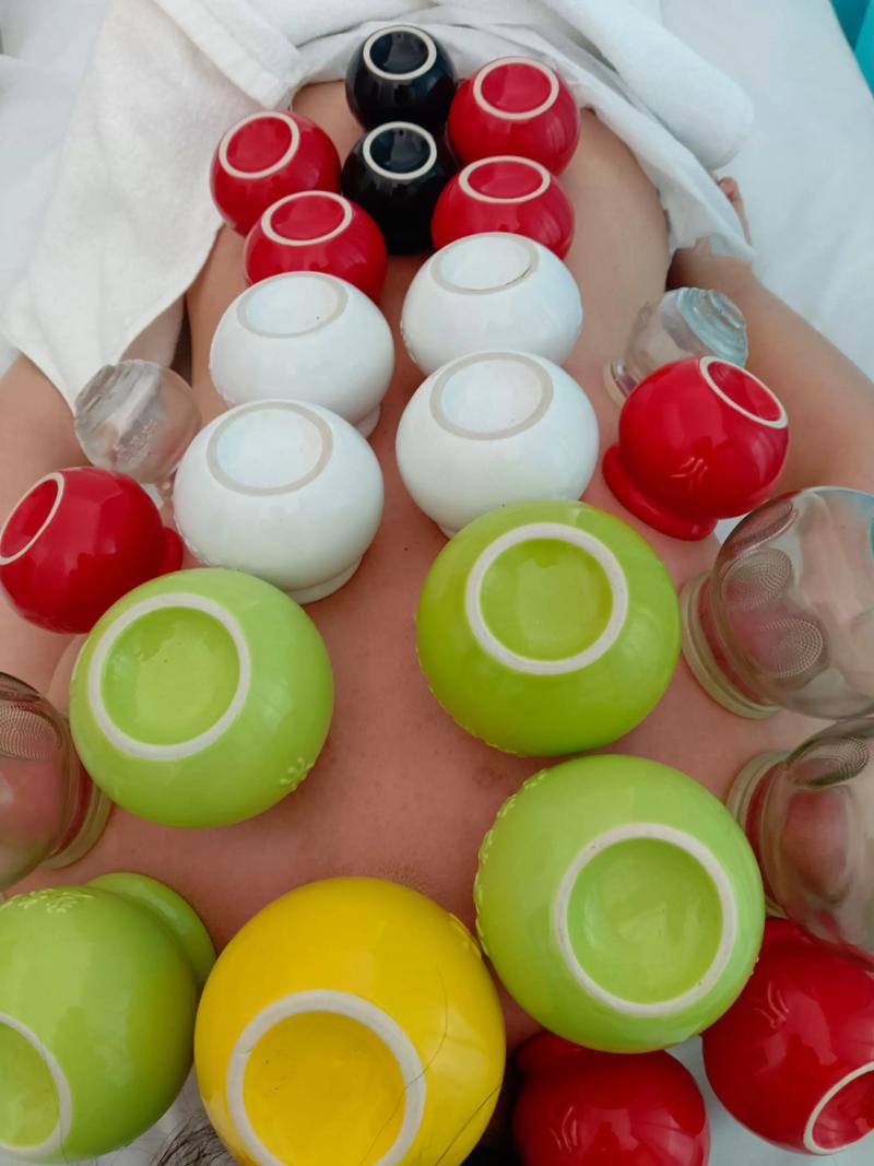 膝盖拔罐后紫是风湿吗