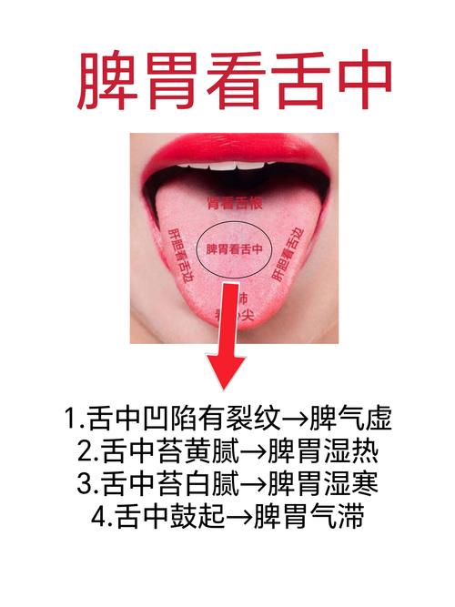 舌头开裂按什么穴位