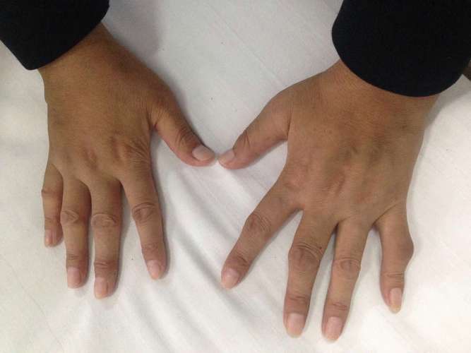 无锡二院风湿科挤不挤