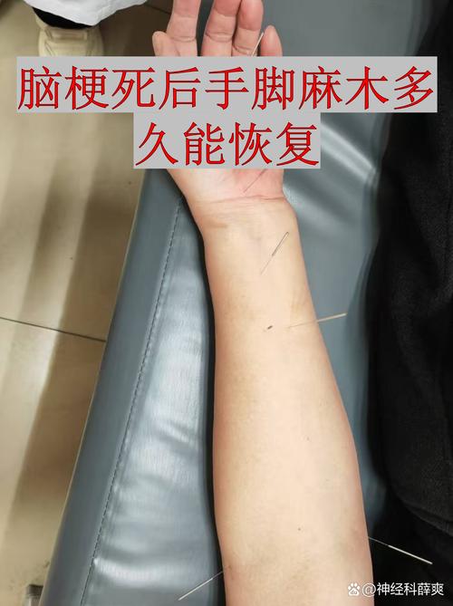 脑梗后恢复期间手臂疼