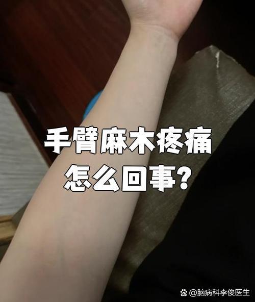 脑梗后恢复期间手臂疼