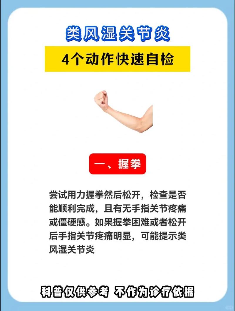 运动治疗类风湿关节炎