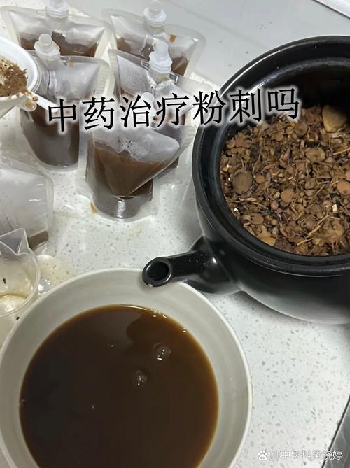 什么样的芥末粉治风湿