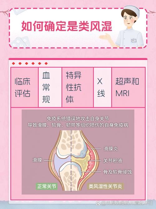 哺乳期类风湿会好转吗