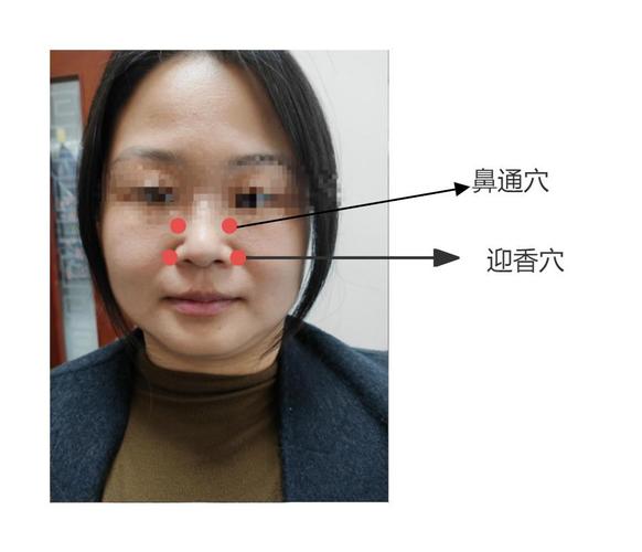 身体过敏掐哪个穴位