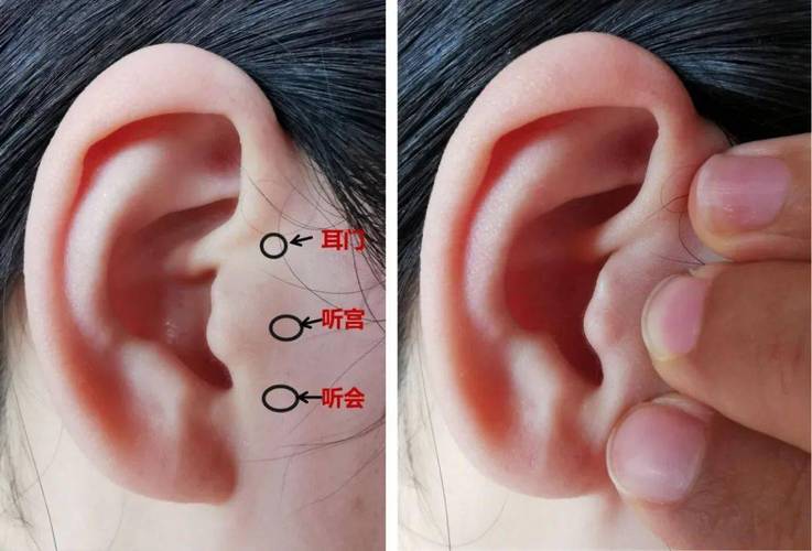 耳门听宫听会穴位图