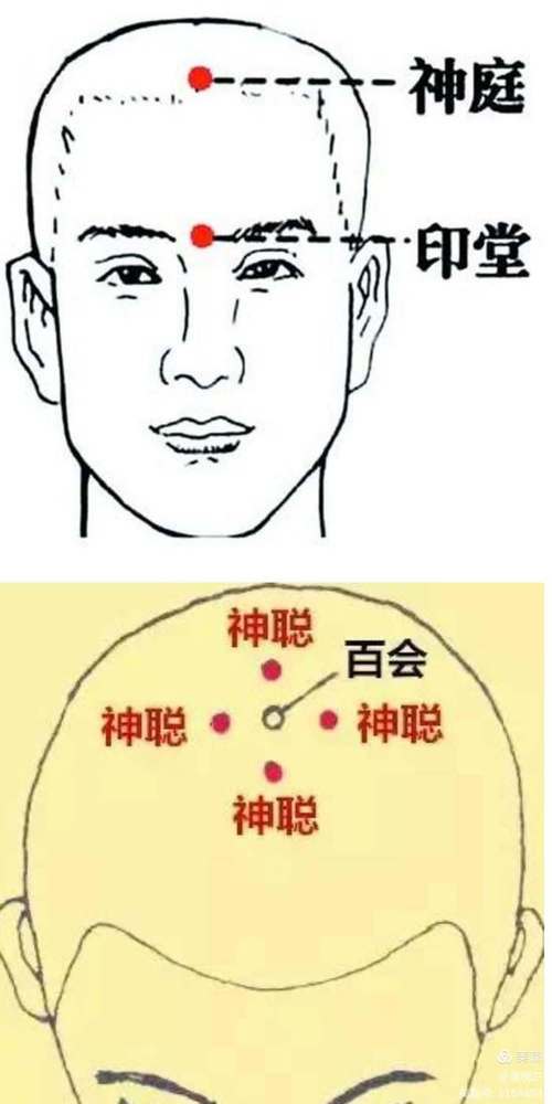 神庭穴位于什么部位