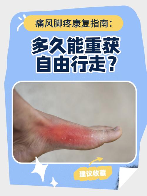 风湿痛风会手脚麻痹吗