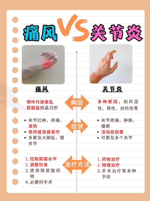 风湿关节炎和骨质增生