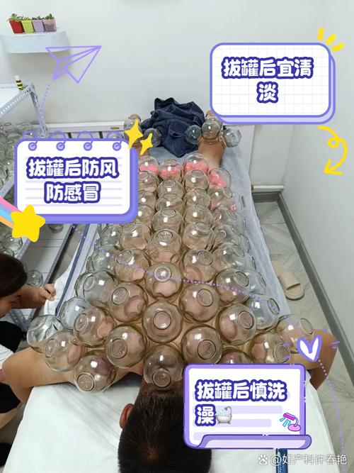 拔火罐后能贴风湿膏吗