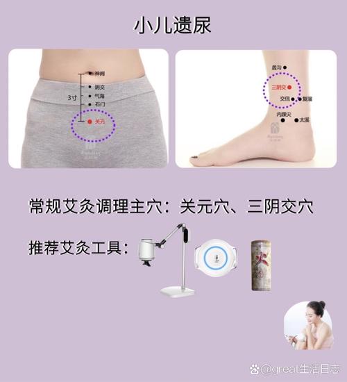 艾灸治疗尿潴留穴位