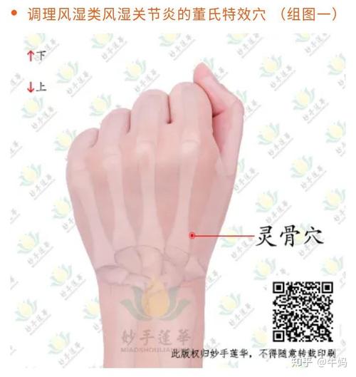 青芥辣对类风湿有效吗