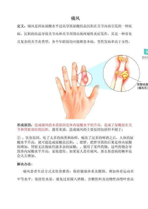 内风湿关节痛如何治疗