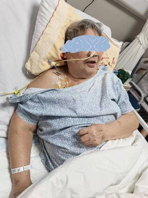 脑梗瘫痪病人呼吸衰竭