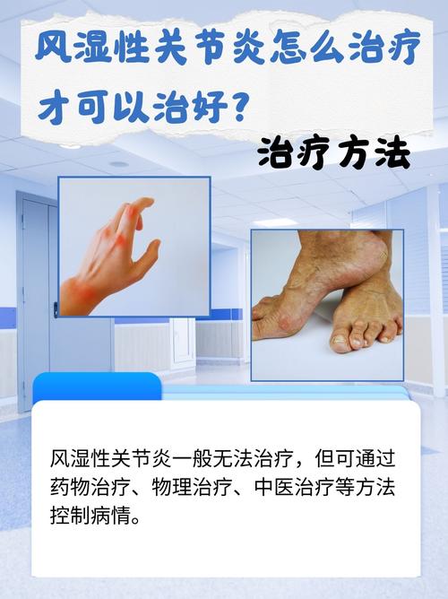 超短波能治疗类风湿吗