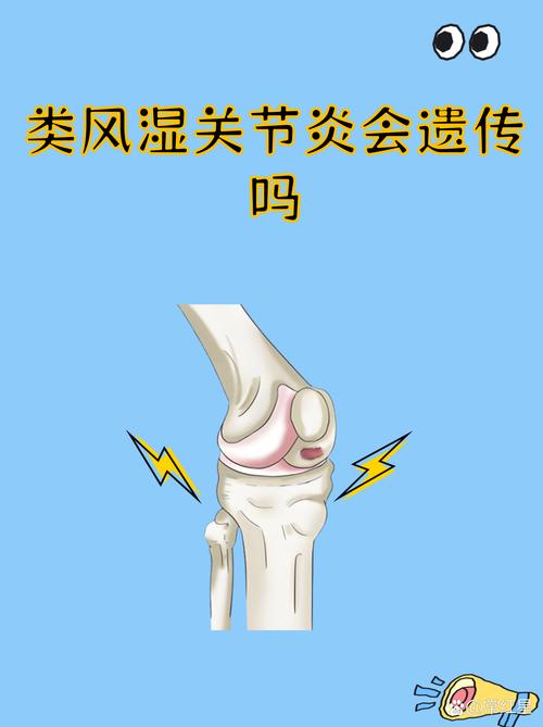 风湿热会遗传给孩子吗