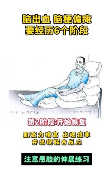 脑梗病人怎么能快速走