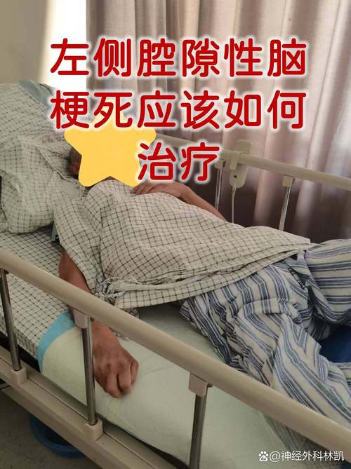 左侧基底节脑梗严重吗